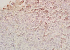 Immunohistochemistry (Formalin/PFA-fixed paraffin-embedded sections) - Anti-Chemerin antibody (AB203040)