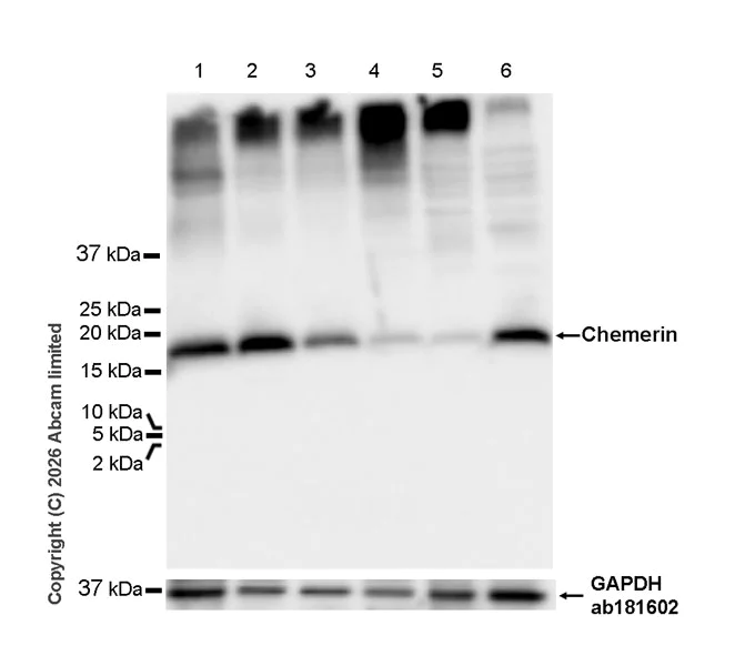 Western blot - Anti-Chemerin antibody [EPR29327-18R] (AB325428)