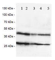 Western blot - Anti-Chemokine Receptor D6 antibody (AB125224)