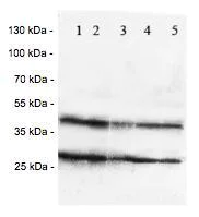 Western blot - Anti-Chemokine Receptor D6 antibody (AB125224)