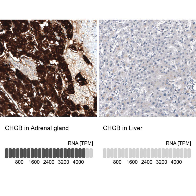 Immunohistochemistry (Formalin/PFA-fixed paraffin-embedded sections) - Anti-CHGB Antibody [CL11404] (AB327134)