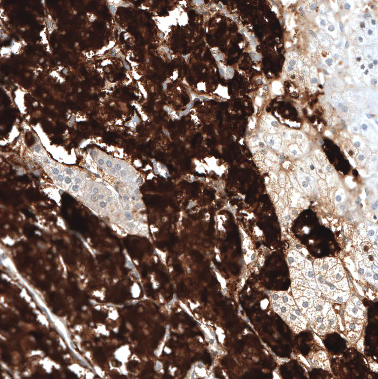 Immunohistochemistry (Formalin/PFA-fixed paraffin-embedded sections) - Anti-CHGB Antibody [CL11404] (AB327134)