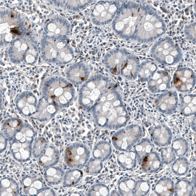 Immunohistochemistry (Formalin/PFA-fixed paraffin-embedded sections) - Anti-CHGB Antibody [CL11404] (AB327134)