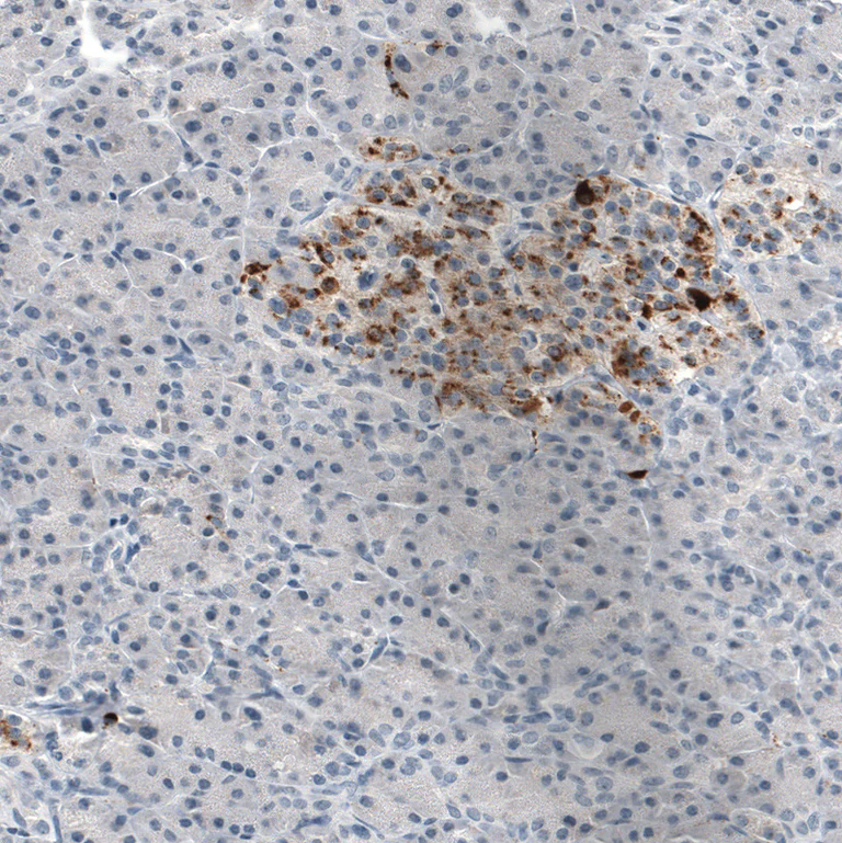 Immunohistochemistry (Formalin/PFA-fixed paraffin-embedded sections) - Anti-CHGB Antibody [CL11404] (AB327134)