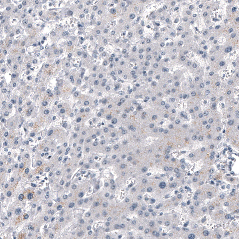 Immunohistochemistry (Formalin/PFA-fixed paraffin-embedded sections) - Anti-CHGB Antibody [CL11404] (AB327134)