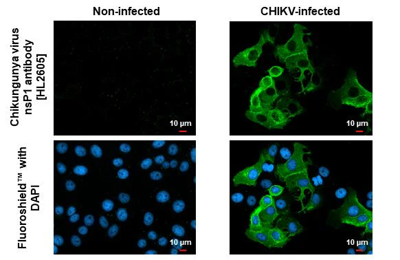 Immunocytochemistry/ Immunofluorescence - Anti-Chikungunya virus nsP1 antibody [HL2605] - BSA and Azide free (AB327523)