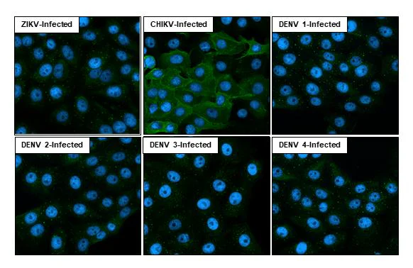Immunocytochemistry/ Immunofluorescence - Anti-Chikungunya virus nsP1 antibody [HL2605] - BSA and Azide free (AB327523)