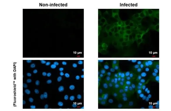 Immunocytochemistry/ Immunofluorescence - Anti-Chikungunya virus nsP2 antibody [HL1431] (AB308396), expandable thumbnail