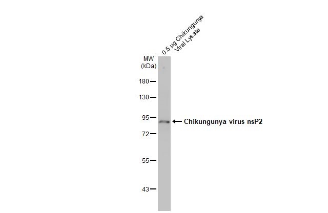 Western blot - Anti-Chikungunya virus nsP2 antibody [HL1431] (AB308396), expandable thumbnail