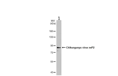 Western blot - Anti-Chikungunya virus nsP2 antibody [HL1431] (AB308396)
