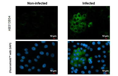 Immunocytochemistry/ Immunofluorescence - Anti-Chikungunya virus nsP2 antibody [HL1488] - BSA and Azide free (AB313934)