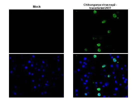 Immunohistochemistry (Formalin/PFA-fixed paraffin-embedded sections) - Anti-Chikungunya virus nsP2 antibody [HL1488] - BSA and Azide free (AB313934)