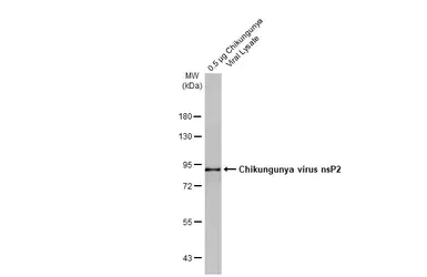 Western blot - Anti-Chikungunya virus nsP2 antibody [HL1488] - BSA and Azide free (AB313934)
