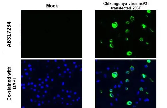 Immunohistochemistry (Formalin/PFA-fixed paraffin-embedded sections) - Anti-Chikungunya virus nsP3 antibody [HL2479] (AB317234)