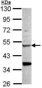 Western blot - Anti-CHIT1 antibody (AB96045)