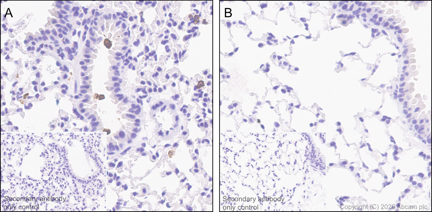 Immunohistochemistry (Formalin/PFA-fixed paraffin-embedded sections) - Anti-Chitinase 3 like protein 3 antibody [EPR21248] (AB230610)