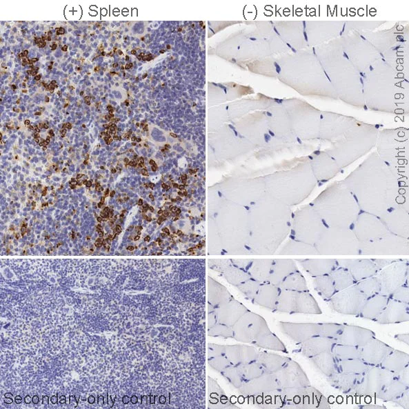 Immunohistochemistry (Formalin/PFA-fixed paraffin-embedded sections) - Anti-Chitinase 3 like protein 3 antibody [EPR21248] (AB230610)