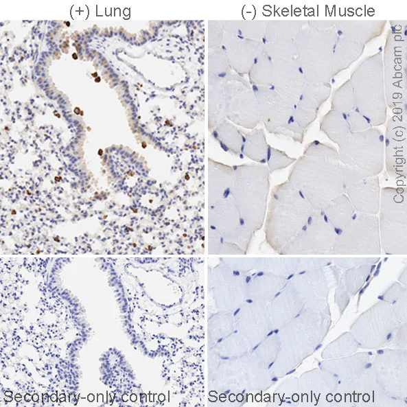 Immunohistochemistry (Formalin/PFA-fixed paraffin-embedded sections) - Anti-Chitinase 3 like protein 3 antibody [EPR21248] (AB230610)