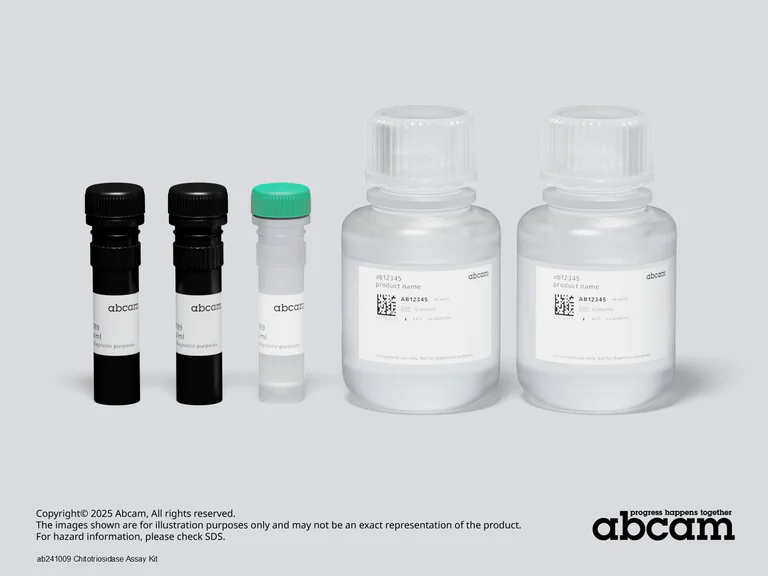 Other - Chitotriosidase Assay Kit (AB241009)