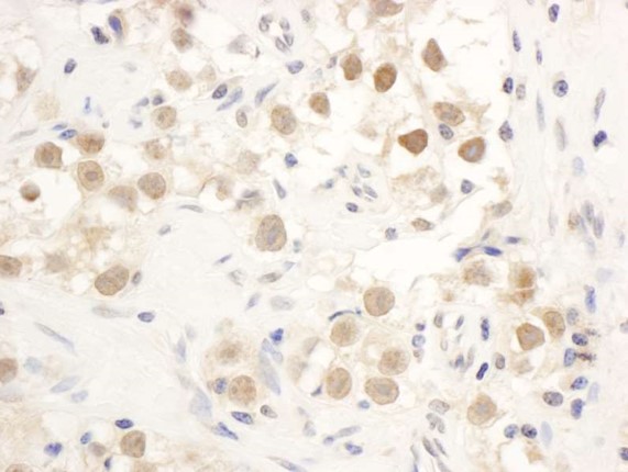 Immunohistochemistry (Formalin/PFA-fixed paraffin-embedded sections) - Anti-Chk1 antibody (AB17191)