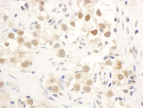 Immunohistochemistry (Formalin/PFA-fixed paraffin-embedded sections) - Anti-Chk1 antibody (AB17191)