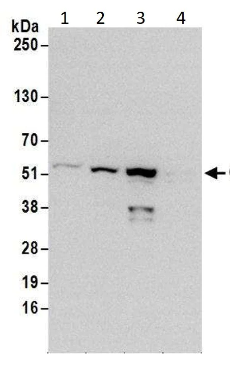 Western blot - Anti-Chk1 antibody (AB17191)