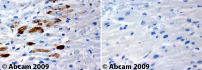Immunohistochemistry (Formalin/PFA-fixed paraffin-embedded sections) - Anti-Chk1 antibody (AB47574), expandable thumbnail