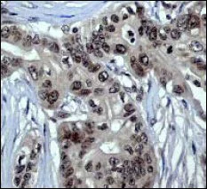 Immunohistochemistry (Formalin/PFA-fixed paraffin-embedded sections) - Anti-Chk1 antibody [EP691Y] (AB40866)