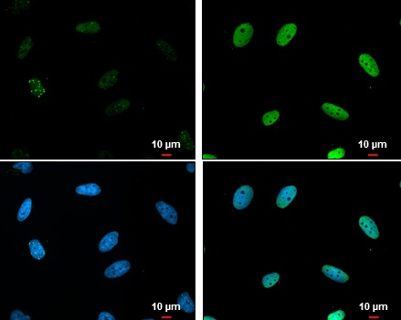 Immunocytochemistry/ Immunofluorescence - Anti-Chk1 (phospho S317) antibody (AB226929), expandable thumbnail