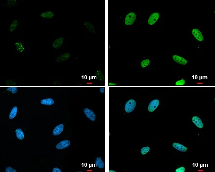 Immunocytochemistry/ Immunofluorescence - Anti-Chk1 (phospho S317) antibody (AB226929)