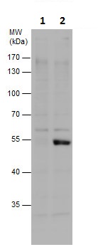 Western blot - Anti-Chk1 (phospho S317) antibody (AB226929), expandable thumbnail