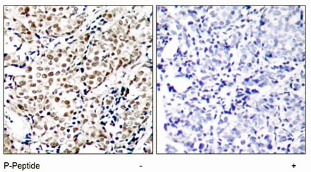 Immunohistochemistry (Formalin/PFA-fixed paraffin-embedded sections) - Anti-Chk1 (phospho S345) antibody (AB47318)