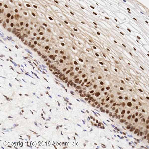 Immunohistochemistry (Formalin/PFA-fixed paraffin-embedded sections) - Anti-Chk1 (phospho S345) antibody (AB58567)