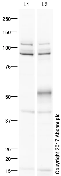 Western blot - Anti-Chk1 (phospho S345) antibody (AB58567)