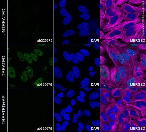 Immunocytochemistry/ Immunofluorescence - Anti-Chk1 (phospho S345) antibody [EPR30270-566] (AB325675)