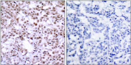 Immunohistochemistry (Formalin/PFA-fixed paraffin-embedded sections) - Anti-Chk2 antibody (AB47433)