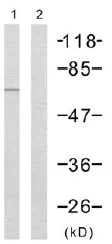 Western blot - Anti-Chk2 antibody (AB47433)