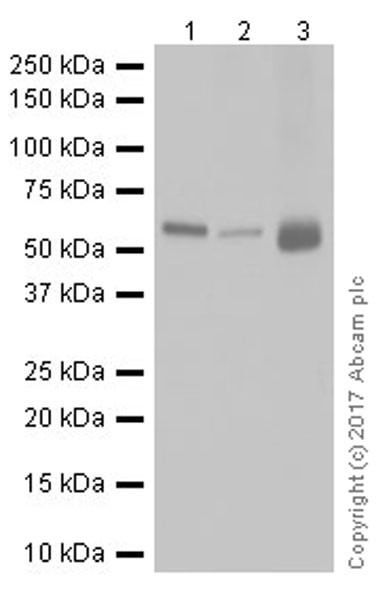 Western blot - Anti-Chk2 antibody [EPR19236] (AB199031)