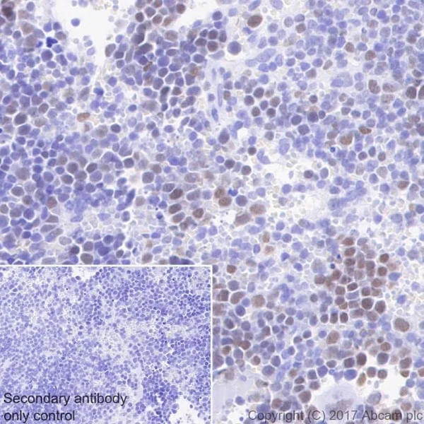 Immunohistochemistry (Formalin/PFA-fixed paraffin-embedded sections) - Anti-Chk2 antibody [EPR19236] - BSA and Azide free (AB271961)