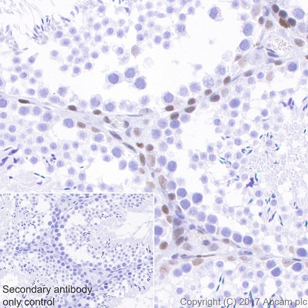 Immunohistochemistry (Formalin/PFA-fixed paraffin-embedded sections) - Anti-Chk2 antibody [EPR19236] - BSA and Azide free (AB271961)