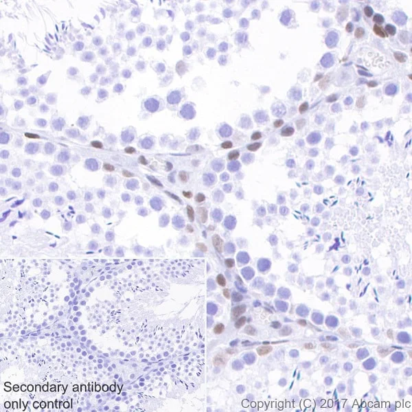 Immunohistochemistry (Formalin/PFA-fixed paraffin-embedded sections) - Anti-Chk2 antibody [EPR19236] - BSA and Azide free (AB271961)