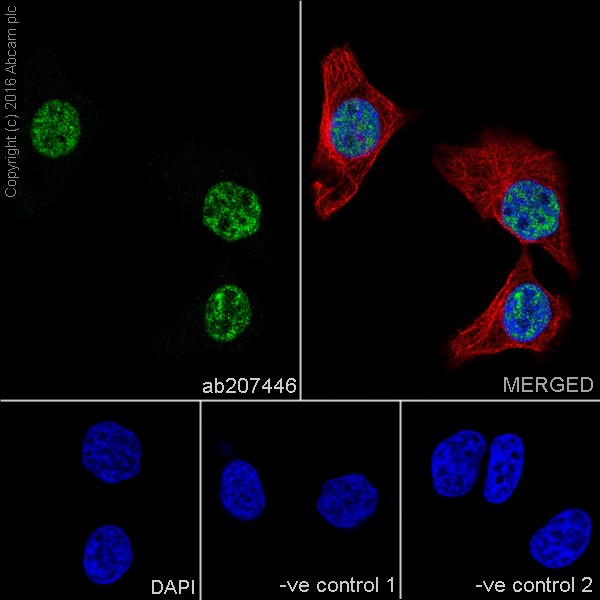 Immunocytochemistry/ Immunofluorescence - Anti-Chk2 antibody [EPR19482] (ab207446), expandable thumbnail