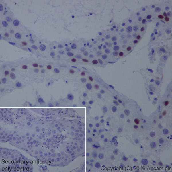 Immunohistochemistry (Formalin/PFA-fixed paraffin-embedded sections) - Anti-Chk2 antibody [EPR19482] (AB207446), expandable thumbnail