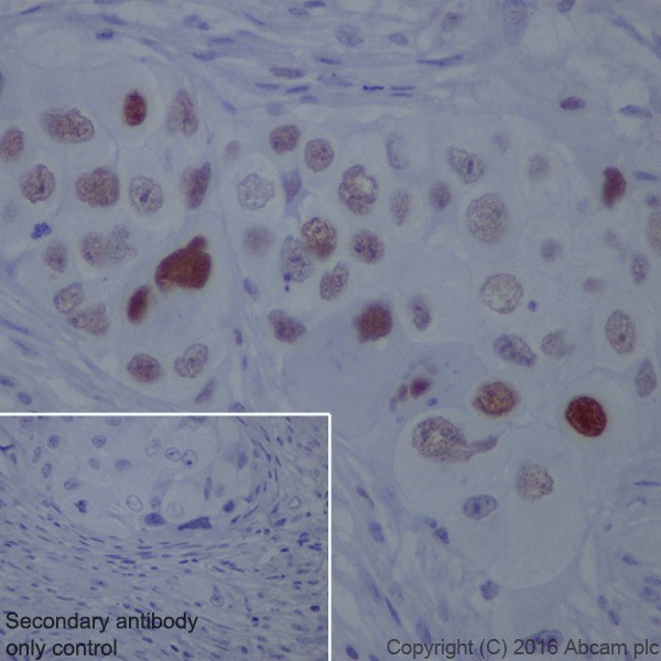 Immunohistochemistry (Formalin/PFA-fixed paraffin-embedded sections) - Anti-Chk2 antibody [EPR19482] (ab207446), expandable thumbnail