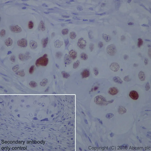 Immunohistochemistry (Formalin/PFA-fixed paraffin-embedded sections) - Anti-Chk2 antibody [EPR19482] (AB207446)