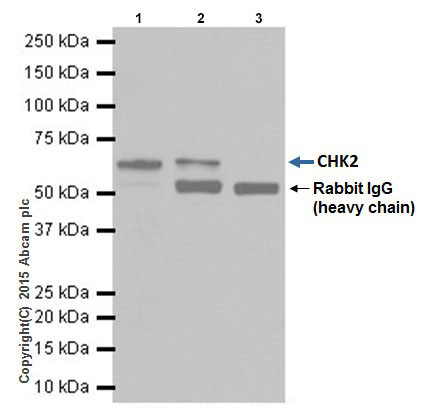 Immunoprecipitation - Anti-Chk2 antibody [EPR19482] (ab207446), expandable thumbnail