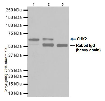 Immunoprecipitation - Anti-Chk2 antibody [EPR19482] (AB207446)