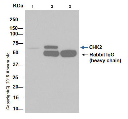 Immunoprecipitation - Anti-Chk2 antibody [EPR19482] (ab207446), expandable thumbnail