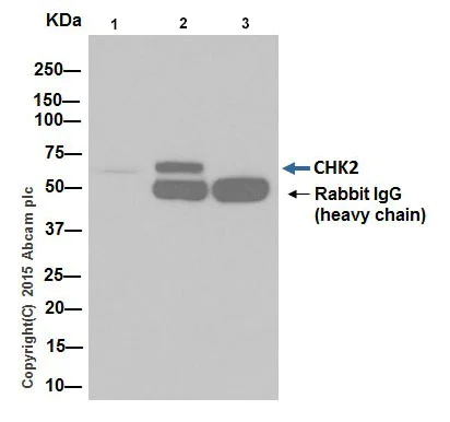 Immunoprecipitation - Anti-Chk2 antibody [EPR19482] (AB207446)