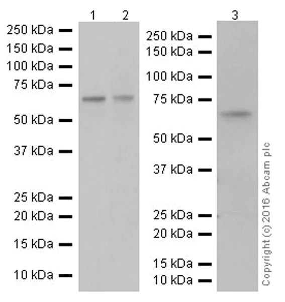 Western blot - Anti-Chk2 antibody [EPR19482] (AB207446)